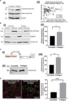 Collagen-I influences the post-translational regulation, binding partners and role of Annexin A2 in breast cancer progression